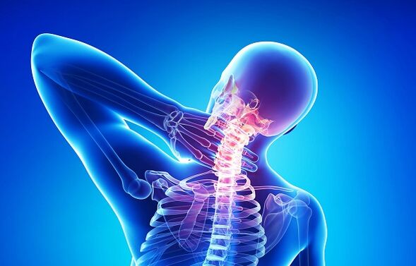 bolečine v vratu z osteohondrozo
