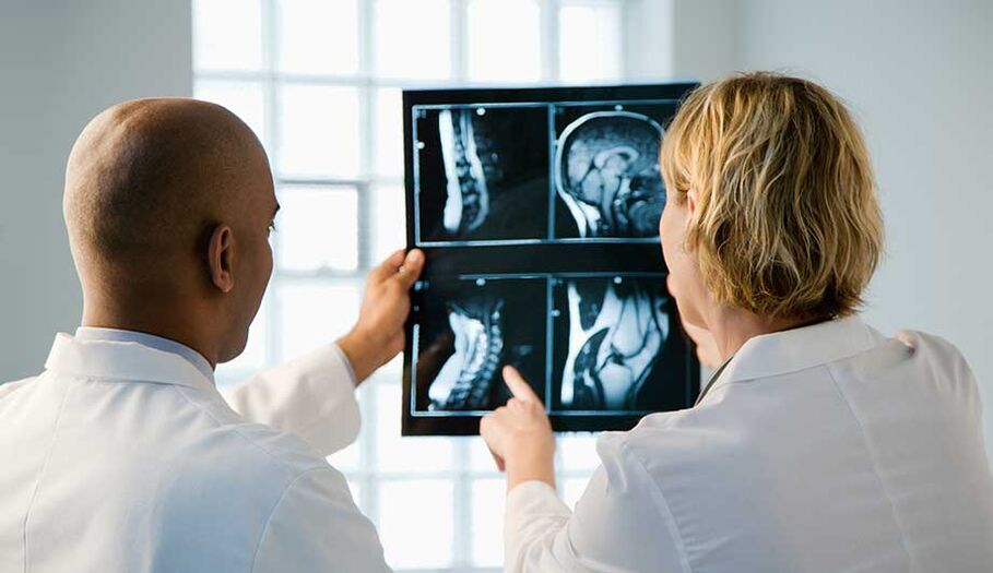diagnoza vratne osteohondroze s slikami
