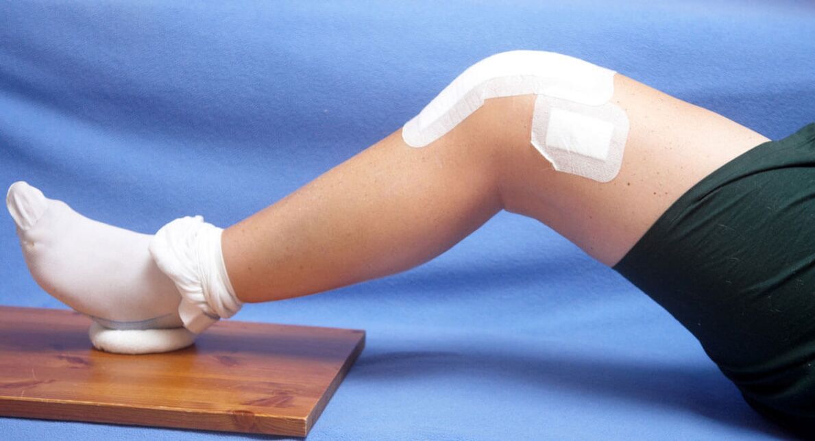 poškodba kolena kot vzrok artroze