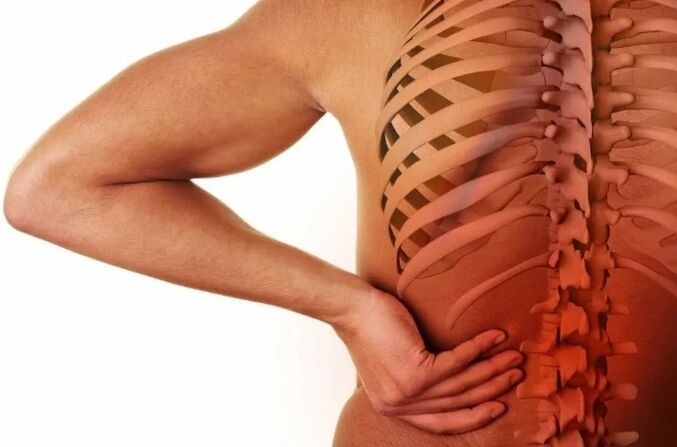 Ledvena osteohondroza