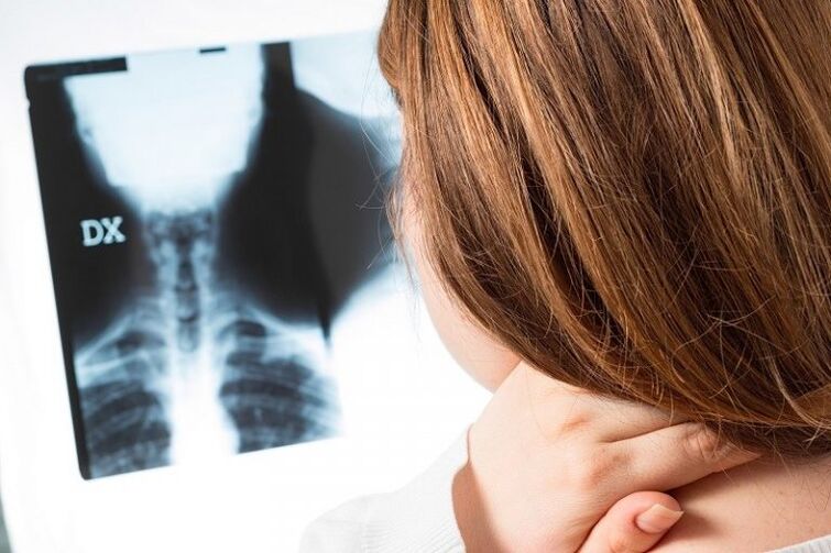 X -ray iz materničnega vratu