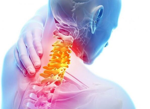 Osteohondroza vratne hrbtenice