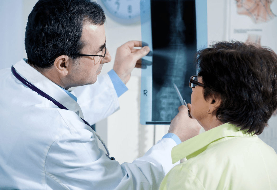 Nevrolog diagnosticira osteohondrozo z radiografijo hrbtenice