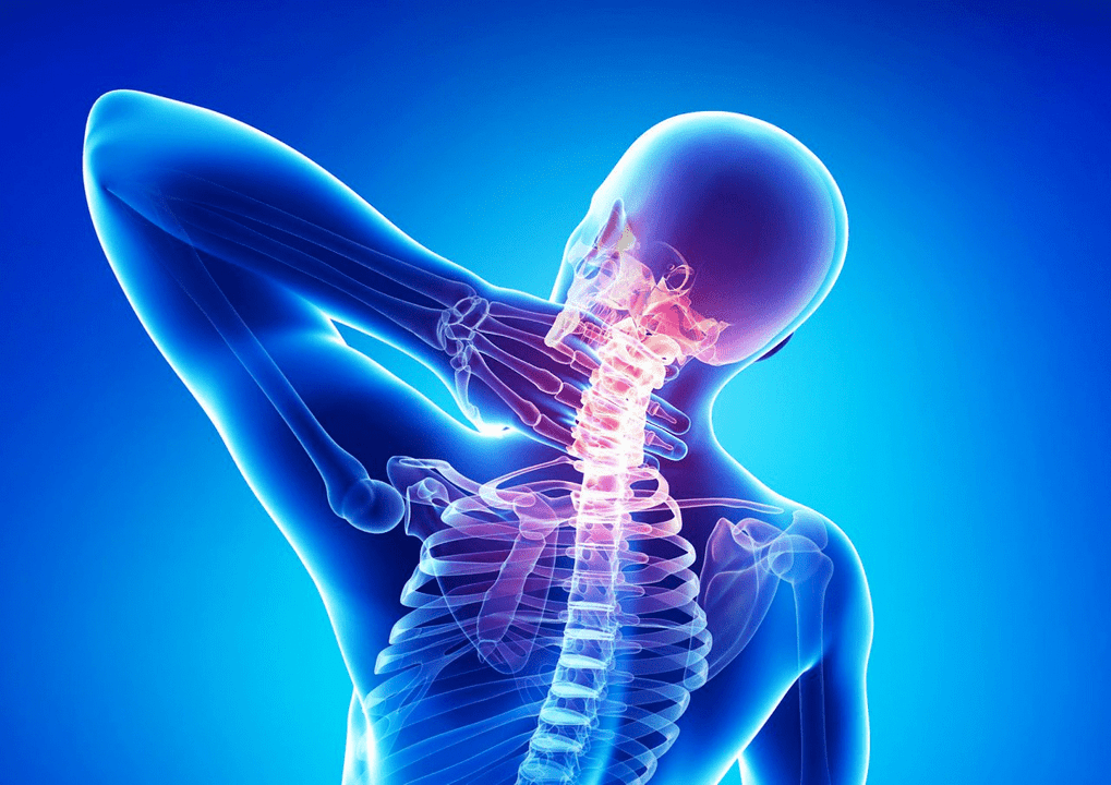 Osteohondroza hrbtenice