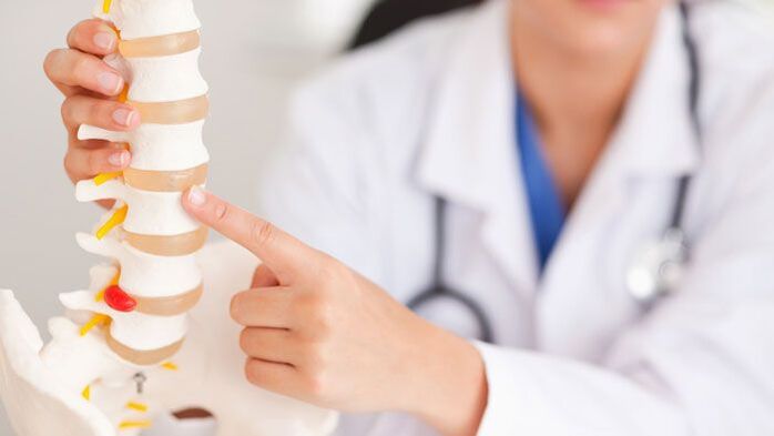 razlaga ledvene osteohondroze na modelu hrbtenice